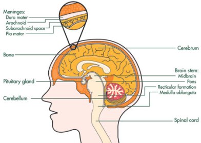 Diagram of meningioma